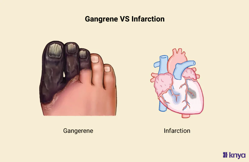 İskemi: Hücresel Açlığın Anatomisi