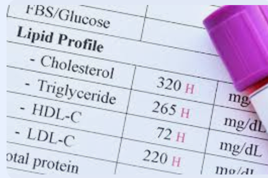 Lipid Paradoksu — Kolesterol, Enflamasyon ve Damar Sırları