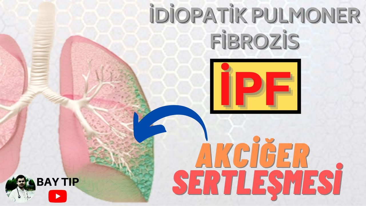 Sertleşen Yaşam: Fibrozis Dokusunun Moleküler İstilası ve İdiyopatik Bilmecenin Çözümü